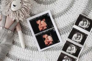 Why is Prenatal Care Important